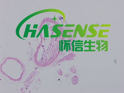 動脈粥樣硬化模型構(gòu)建